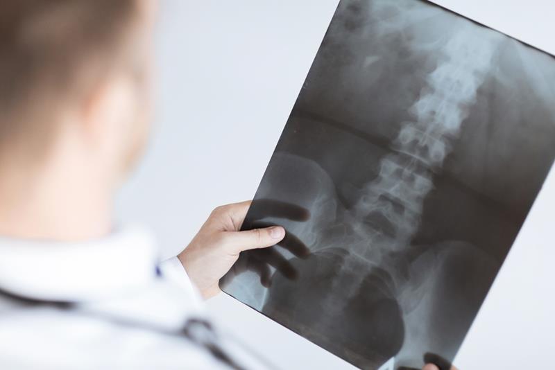 X-Rays  San Juan, PR